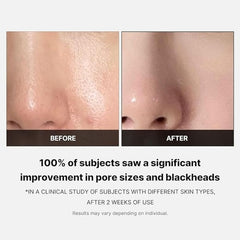 Medicube Zero Pore Pad 2.0 70pads